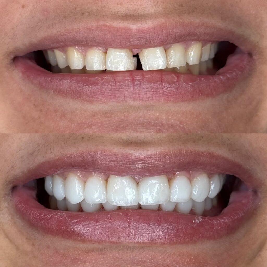 Cada sorriso conta uma história e hoje ajudamos a transformar mais uma 🤍Tratamento pensado para (2)
