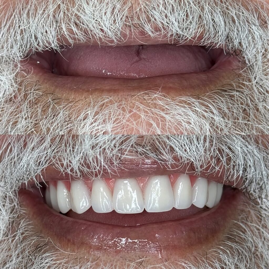 Mais uma transformação entregue com sucesso na unidade doCristo Rei! Hoje foi dia de sorriso nov (4)