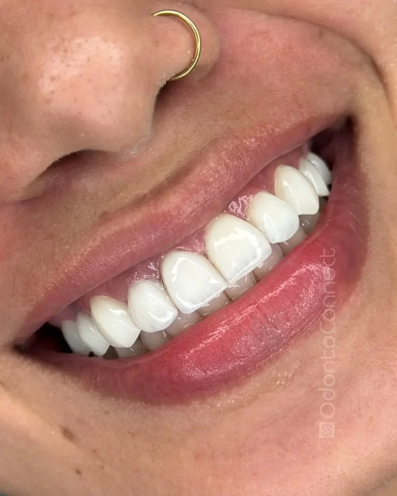 Cada sorriso conta uma história e hoje ajudamos a transformar mais uma 🤍Tratamento pensado para (3)