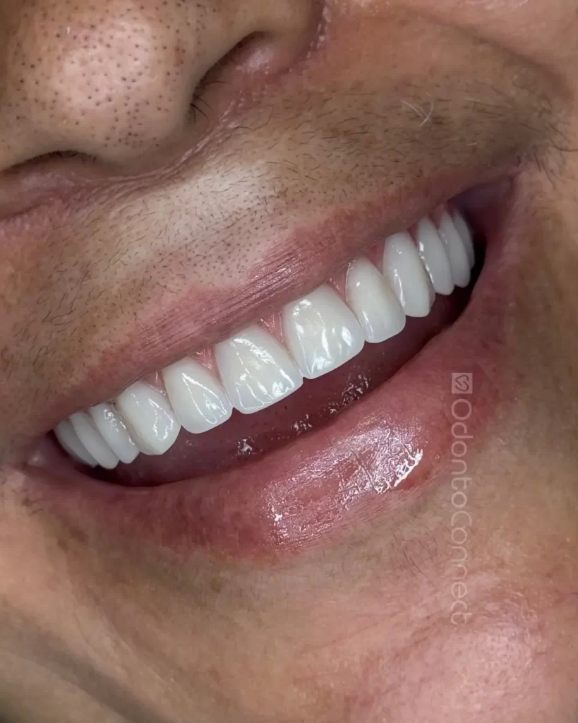 Mais uma transformação entregue com sucesso na unidade doCristo Rei! Hoje foi dia de sorriso nov (5)
