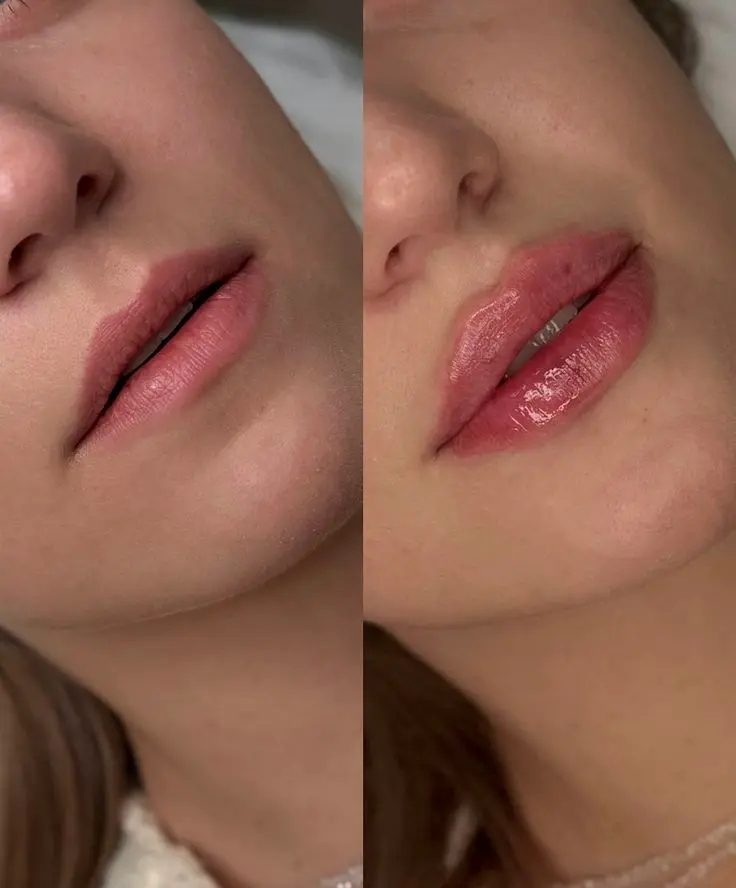 P. LABIAL 1