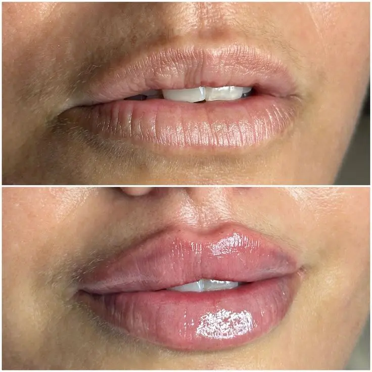 P. LABIAL 3